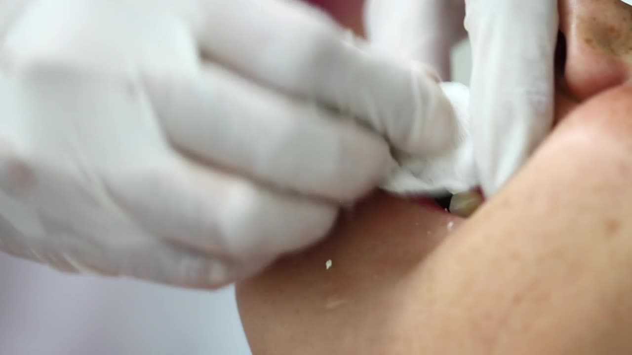 Stock Video Dentist Hands Preparing A Patient Live Wallpaper For PC