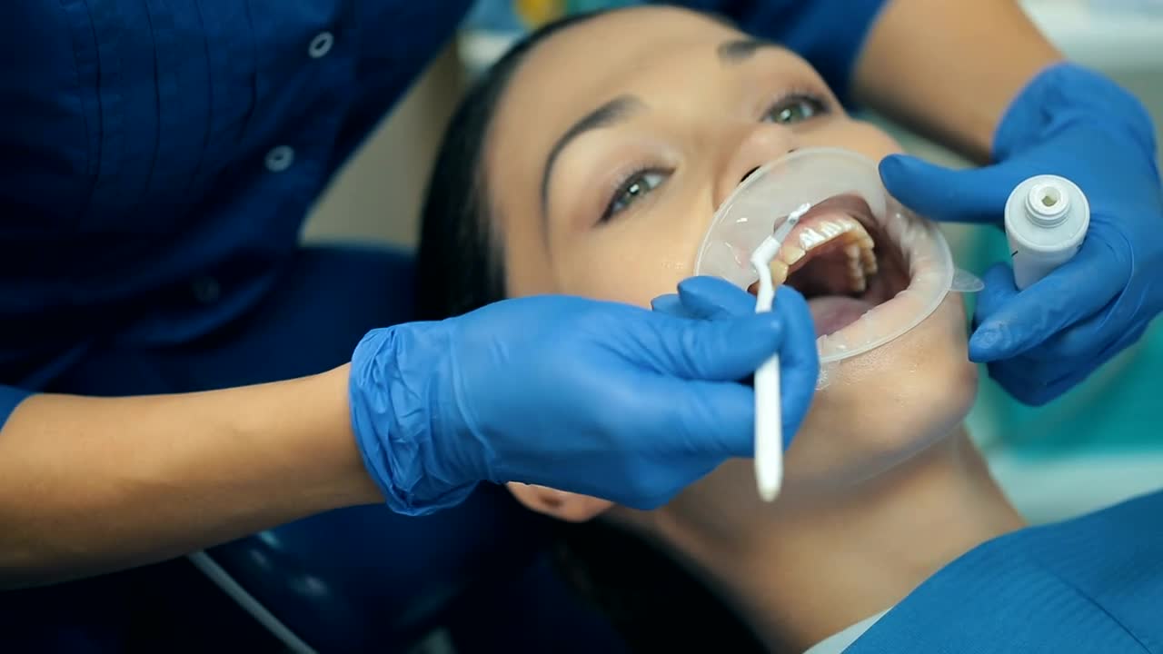 Stock Video Dentist Hands Cleaning Teeth To A Patient Live Wallpaper For PC