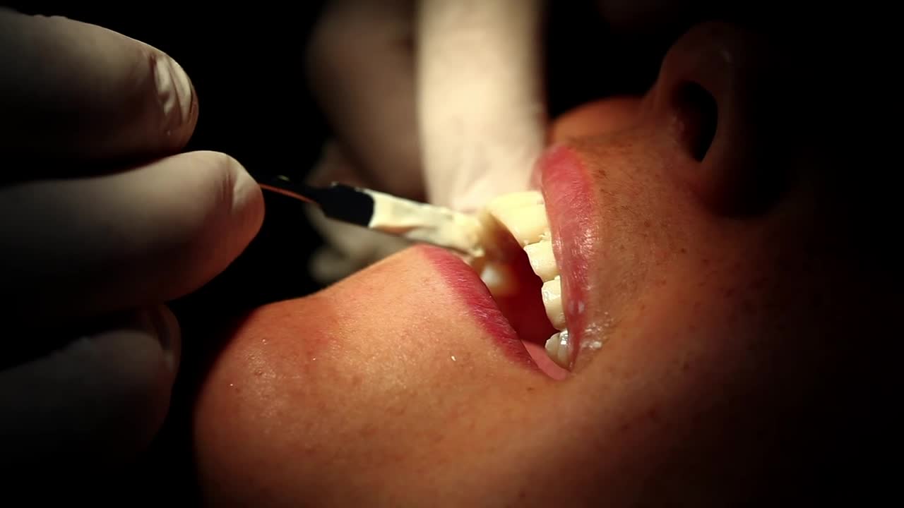 Stock Video Dental Surgery Close Up Live Wallpaper For PC