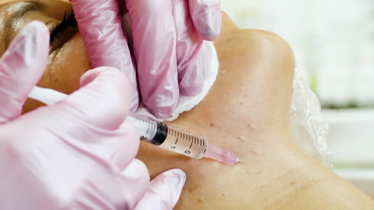 Stock Video Cosmetologist Making Face Lifting Injections Live Wallpaper For PC