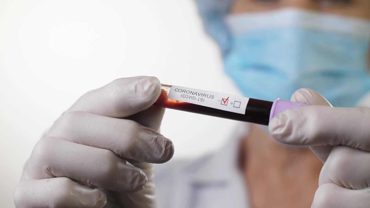 Stock Video Coronavirus Test In The Hands Of A Doctor Live Wallpaper For PC