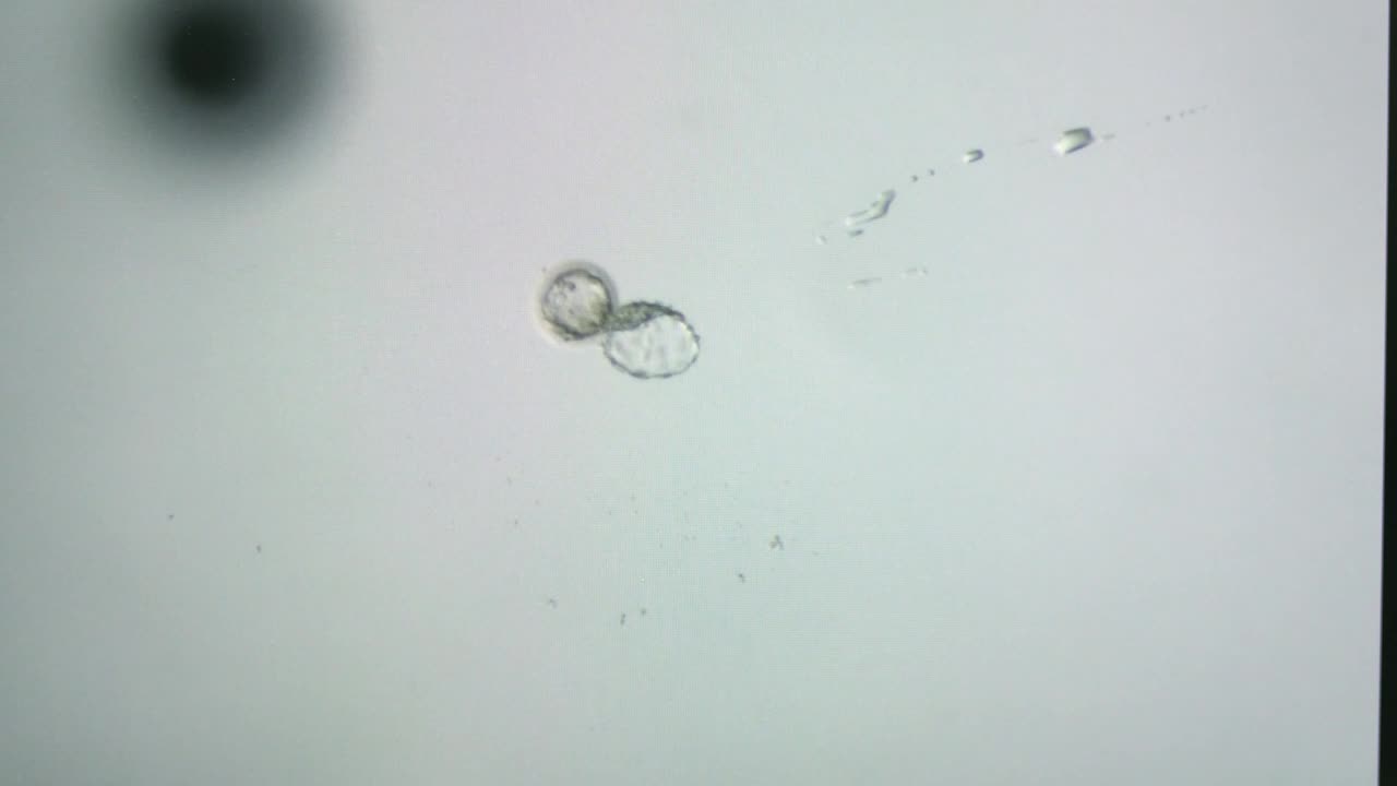 Stock Video Embryo Under A Microscope View Live Wallpaper For PC