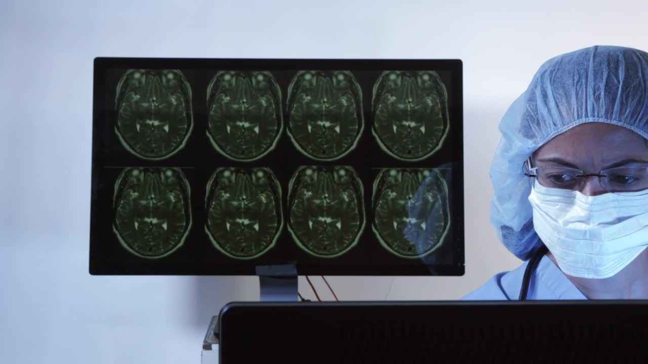 Stock Video Doctor Reviewing Scan Results Live Wallpaper For PC