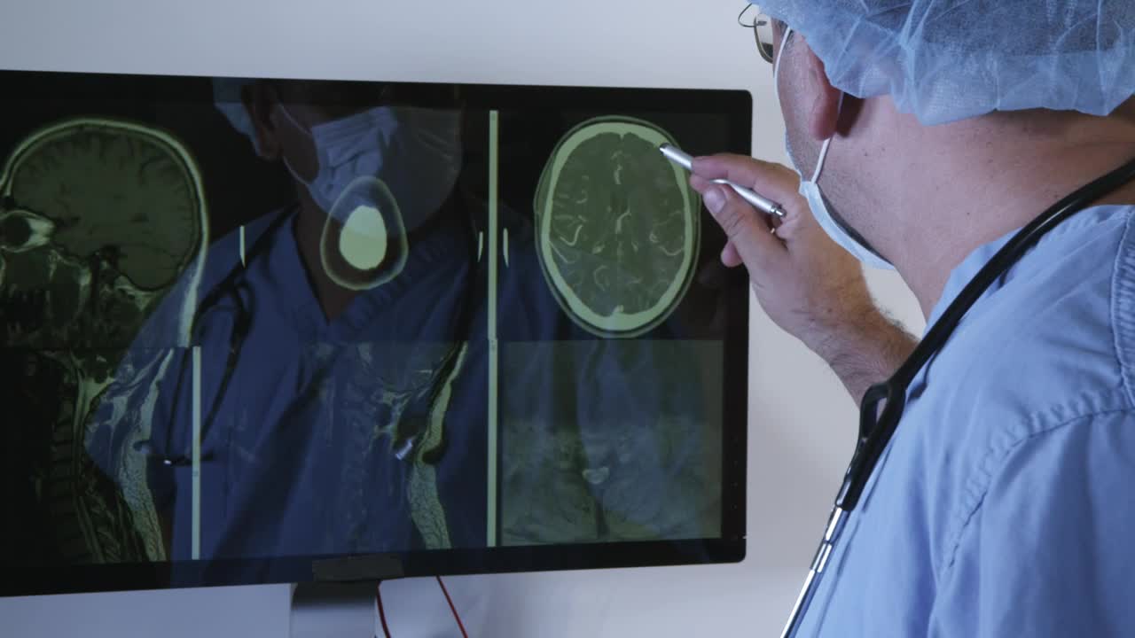 Stock Video Doctor Reviewing A Brain Scan Live Wallpaper For PC