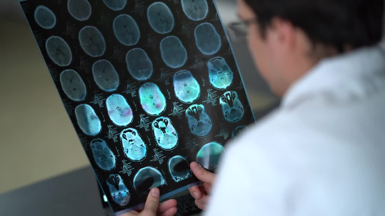 Stock Video Doctor Looking At An X Ray Of The Skull Live Wallpaper For PC