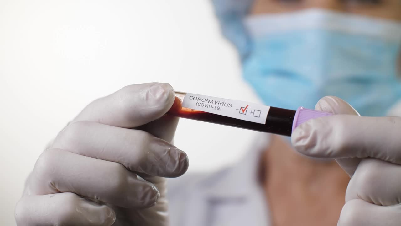 Stock Video Doctor Holding A Covid  Blood Test Live Wallpaper For PC