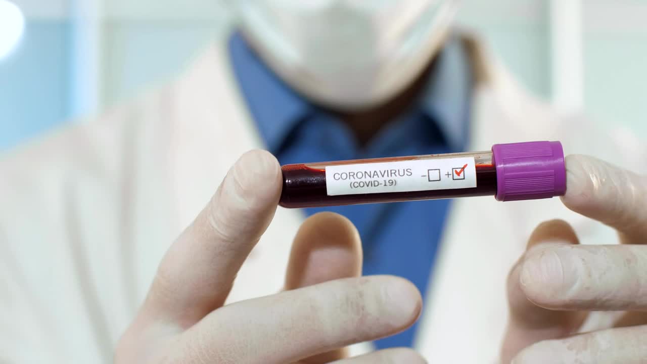 Stock Video Doctor Holding A Blood Sample With Coronavirus Live Wallpaper For PC