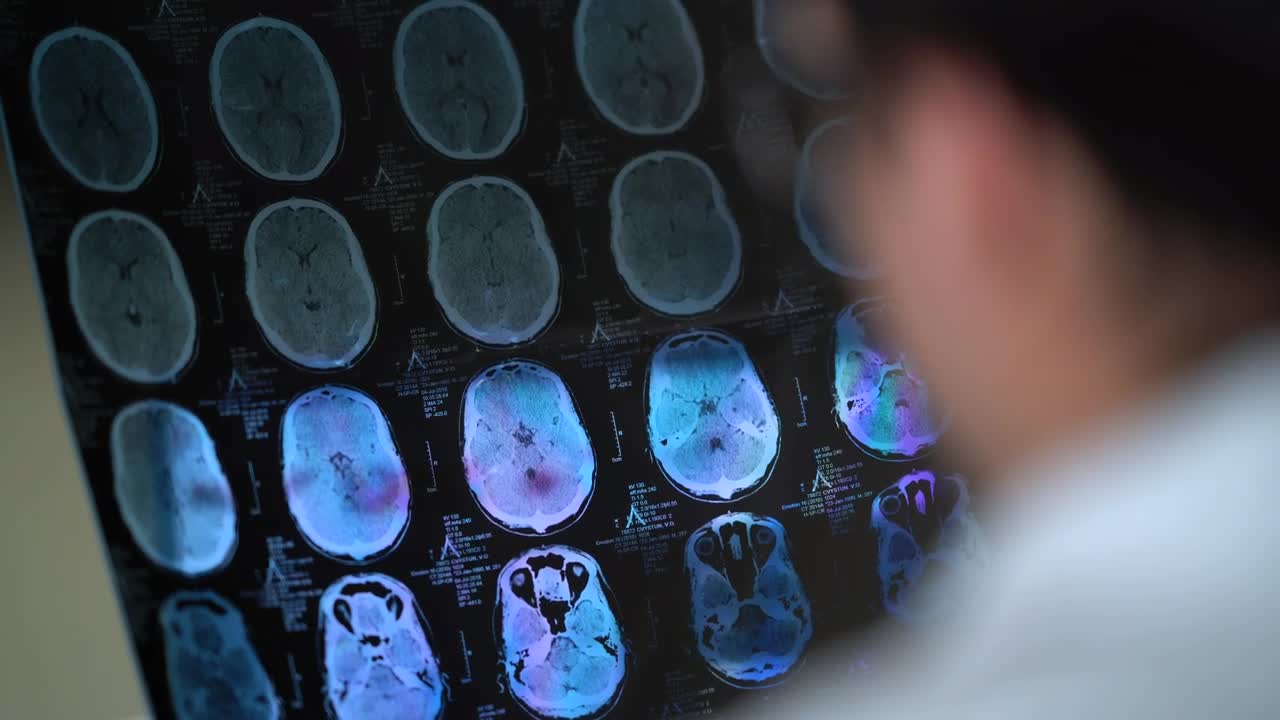 Stock Video Doctor Analyzing A Skull Tomography Live Wallpaper For PC