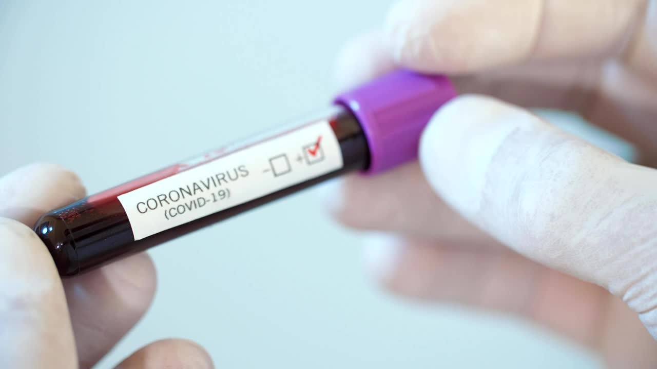 Stock Video Gloved Hands Holding A Positive Coronavirus Test Live Wallpaper For PC