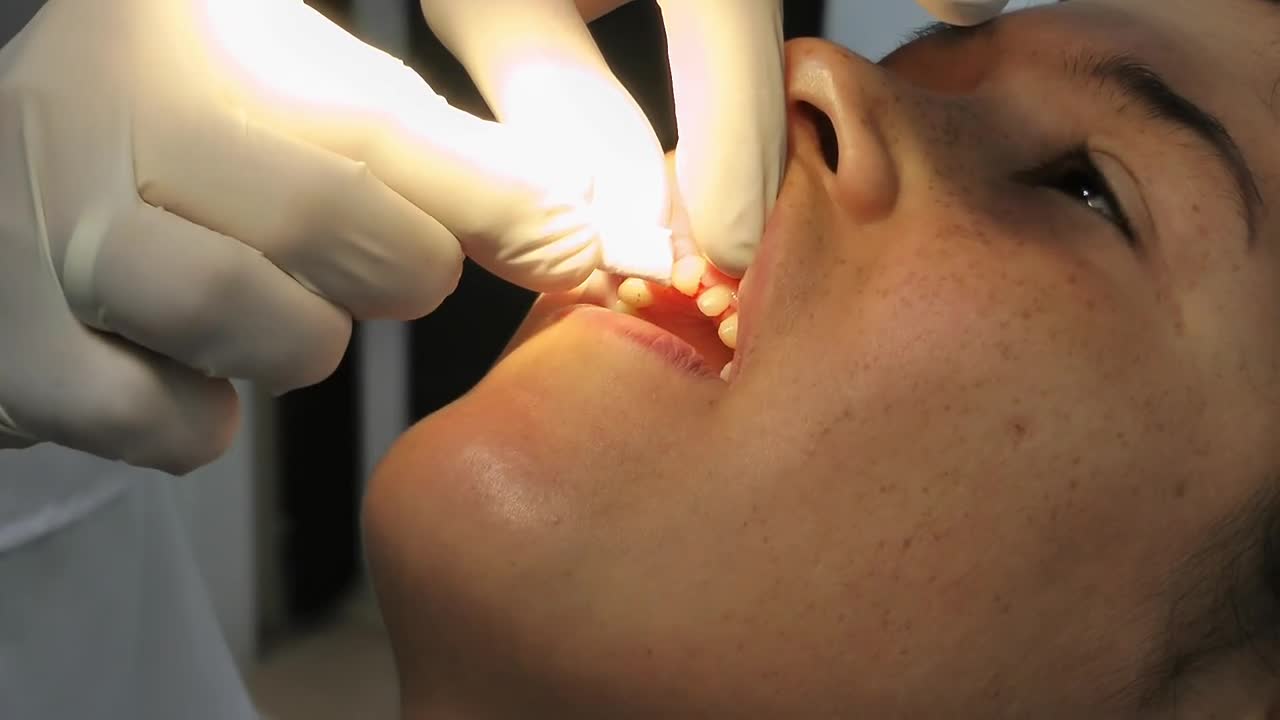 Stock Video Girl In A Procedure At The Dentist Live Wallpaper For PC