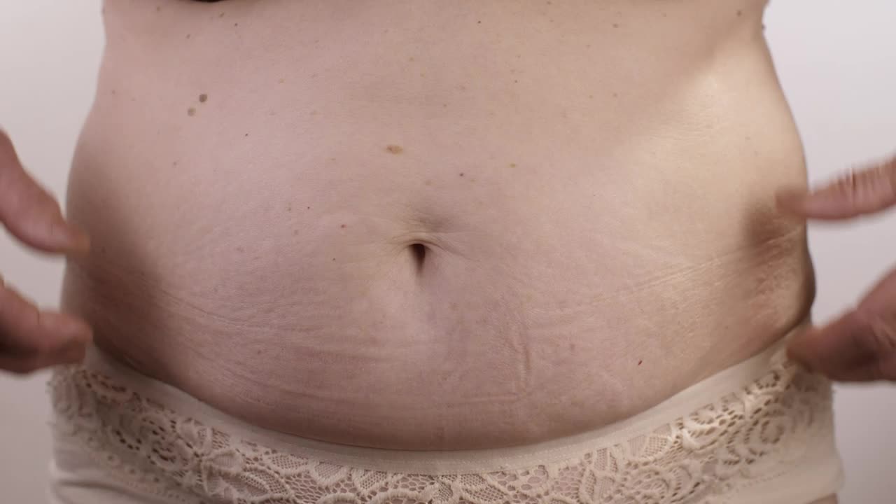 Stock Video Obese Woman Touching Her Stomach Live Wallpaper