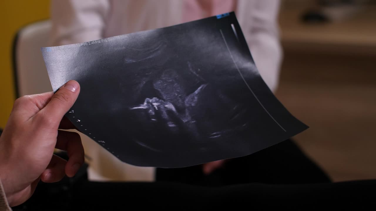 Stock Video Parents Holding An Ultrasound Photo Live Wallpaper