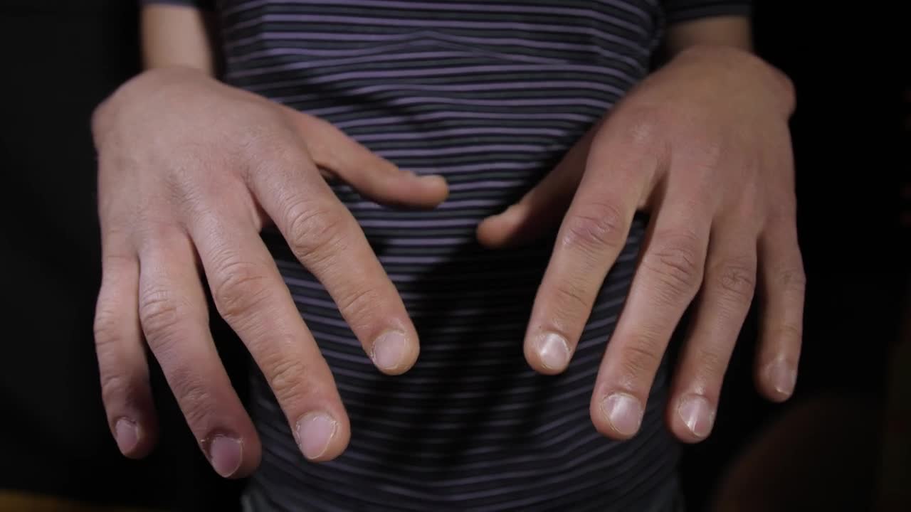 Stock Video Parkinsons Sick Person Live Wallpaper