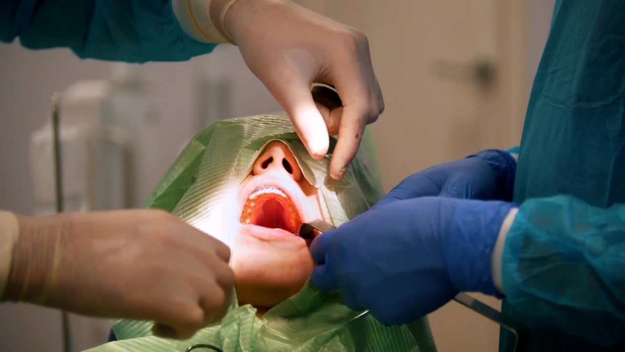 Free Video Stock surgeons working on a patients mouth Live Wallpaper