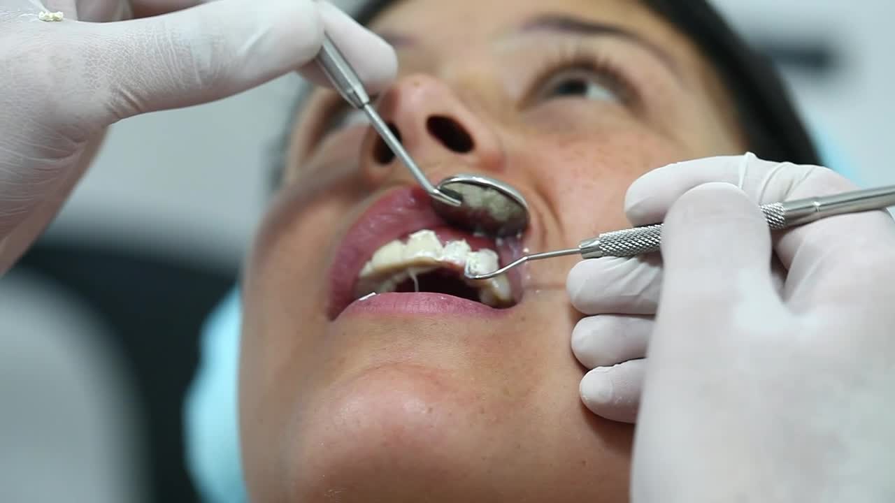 Stock Video Dentist Hands Cleaning Teeth Before Surgery Live Wallpaper For PC
