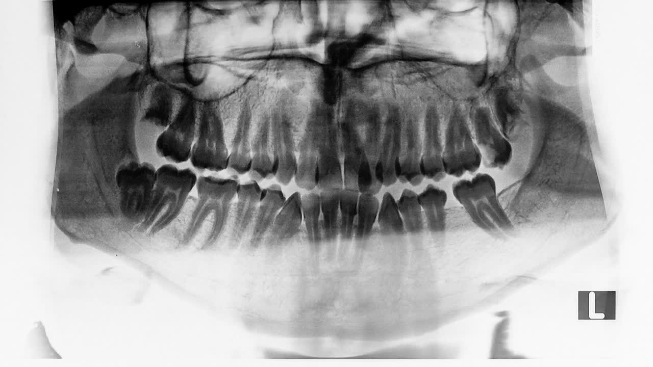 Stock Video Dental X Ray Live Wallpaper For PC