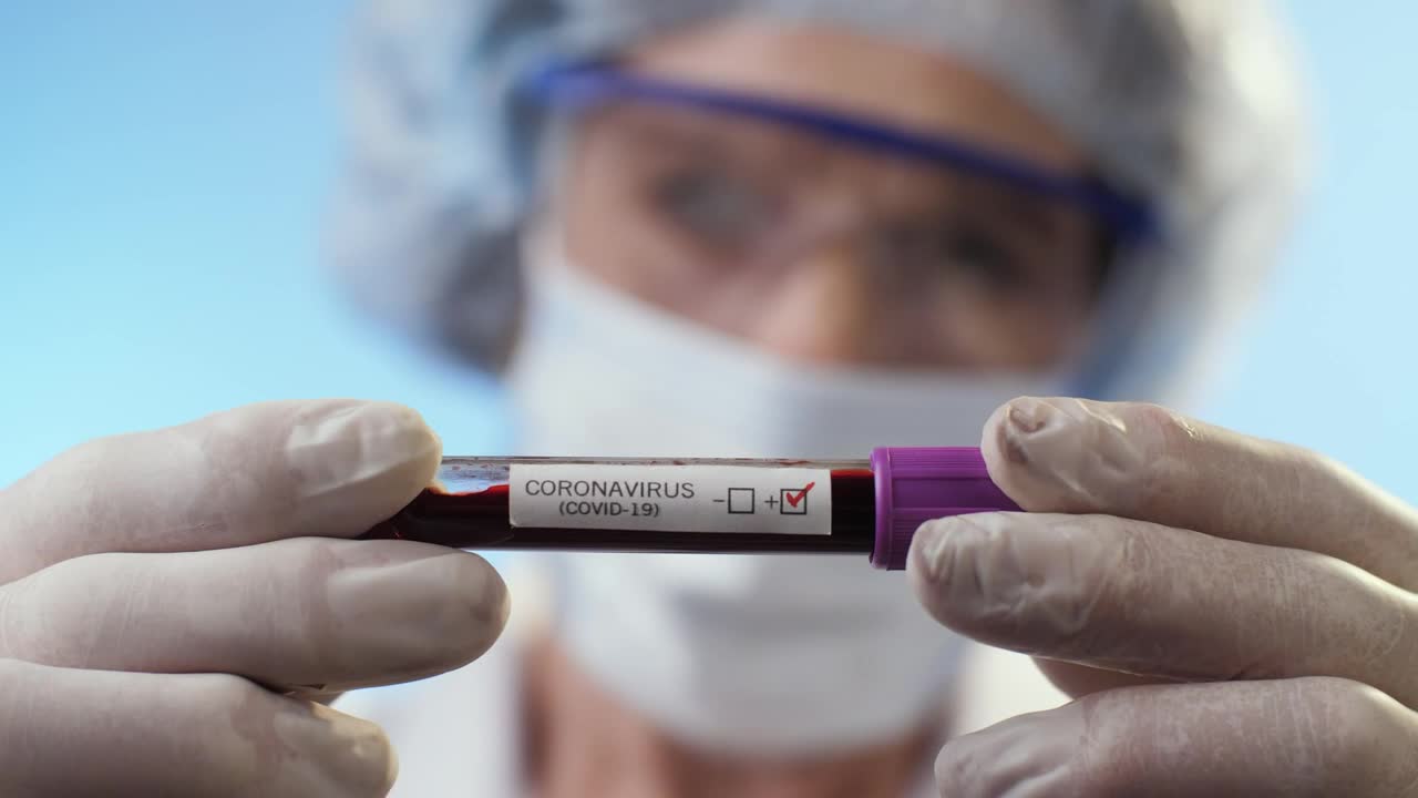 Video Stock Positive Coronavirus Test Results Live Wallpaper Free